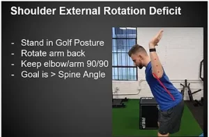 Shoulder external rotation deficiency test.